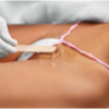 Brazilian Wax