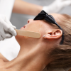 Scar Treatment